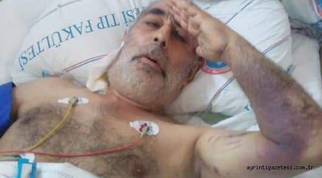 AKPINAR HAYATINI KAYBETTİ